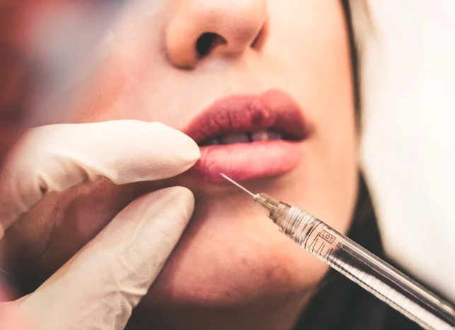 The Ideal Destination For Lip Fillers