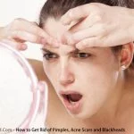 How to get rid of pimples and acne scars