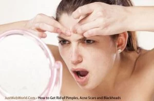 How to Get Rid of Pimples, Acne Scars and Blackheads