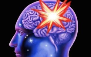Cerebral haemorrhage