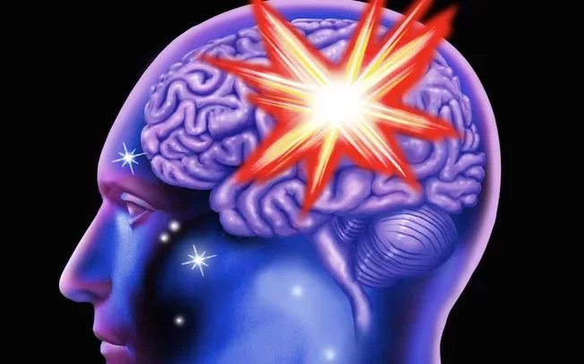 Cerebral haemorrhage