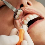 In Depth Guide to Dental Crowns