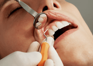 Dental Crowns
