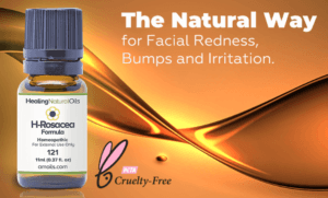 H-Rosacea Formula Review