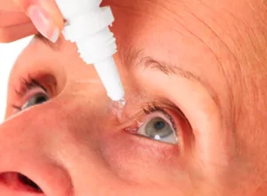 What are Cataracts