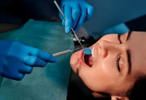 Root Canal Experts