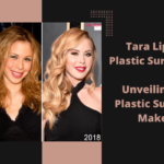 Tara Lipinski Plastic Surgery: Unveiling Her Plastic Surgery Makeover!