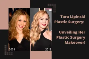 Tara Lipinski Plastic Surgery: Unveiling Her Plastic Surgery Makeover!