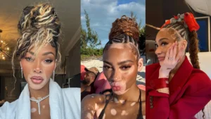 Winnie Harlow behind the scenes at a photoshoot, redefining beauty in the modeling world